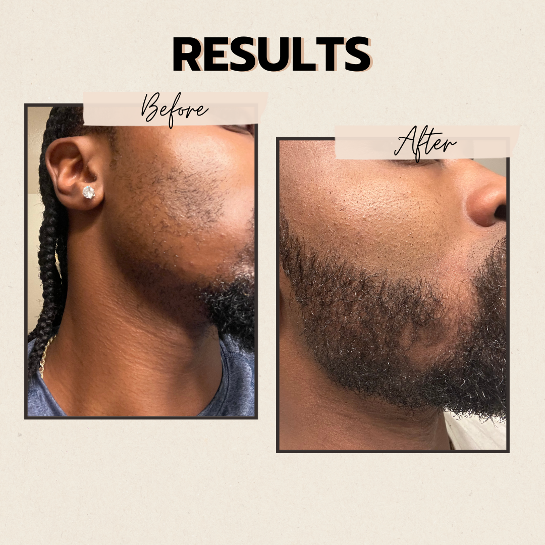 The Beard Growth Bundle