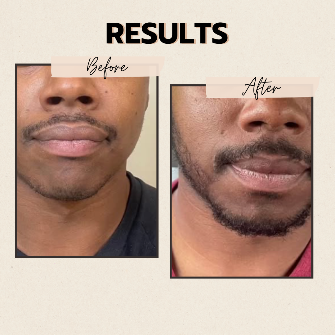 The Beard Growth Bundle