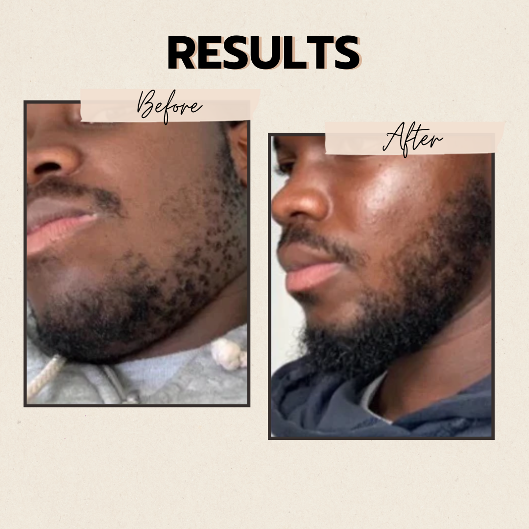The Beard Growth Bundle